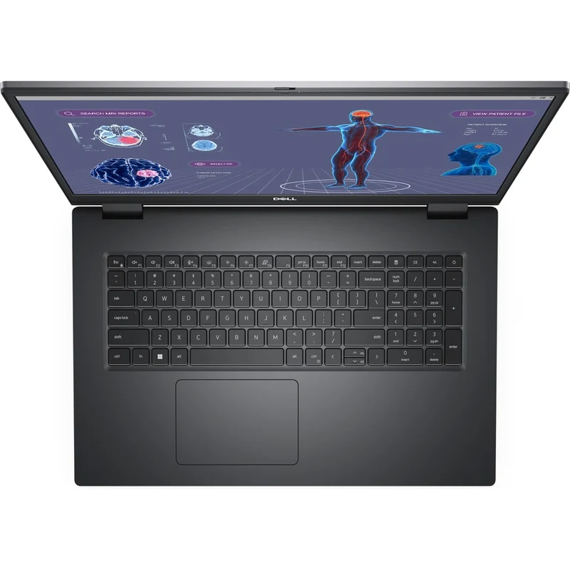 Station de travail mobile Dell Precision 7000 7780 17" - Full HD - Intel Core i9 de 13e génération (i9-13950HX) - Technologie vPro - 64 Go - SSD de 1 To - Clavier anglais (États-Unis) - Gris titane (aluminium) 3GCR6